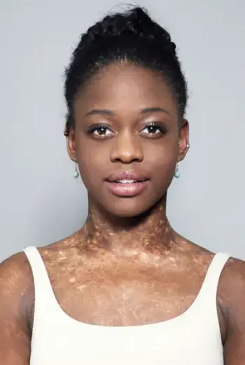 Michaela DePrince