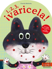 1, 2, 3... ¡Varicela!