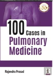 100 Cases In Pulmonary Medicine