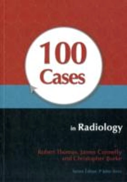 Bertrand.pt - 100 Cases In Radiology