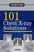 101 Chest X-Ray Solutions