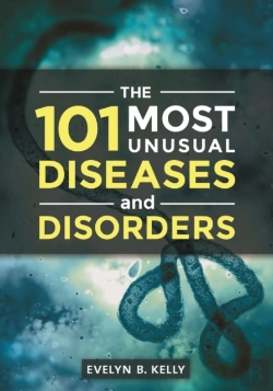 Bertrand.pt - 101 Most Unusual Diseases And Disorders