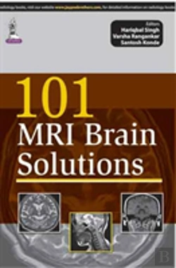 Bertrand.pt - 101 Mri Brain Solutions