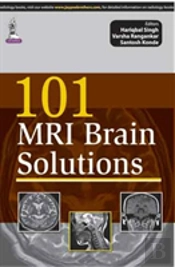 101 Mri Brain Solutions