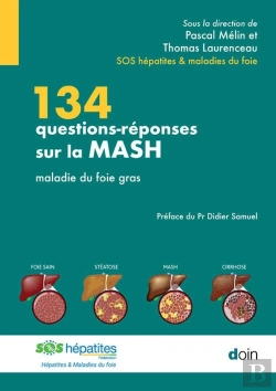 Bertrand.pt - 134 Questions-Réponses Sur La Mash : Maladie Du Foie Gras
