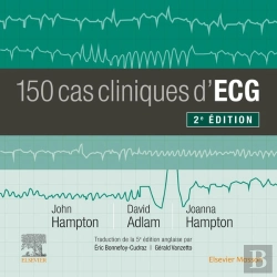 Bertrand.pt - 150 Cas Cliniques D'Ecg (2e Édition)