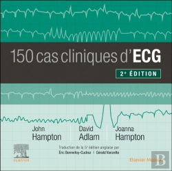 Bertrand.pt - 150 Cas Cliniques D'Ecg