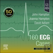 160 Ecg Cases