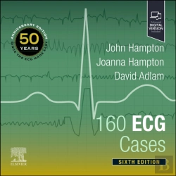 Bertrand.pt - 160 Ecg Cases