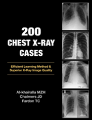 200 Chest X-Ray Cases