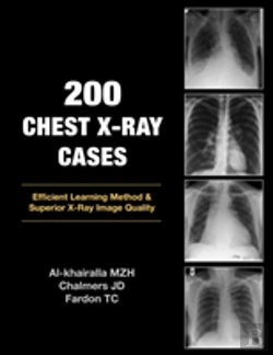 Bertrand.pt - 200 Chest X-Ray Cases