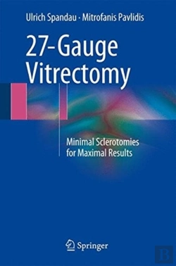Bertrand.pt - 27-Gauge Vitrectomy