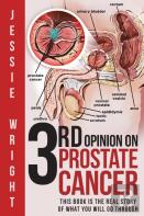 3rd Opinion On Prostate Cancer