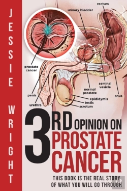 Bertrand.pt - 3rd Opinion On Prostate Cancer