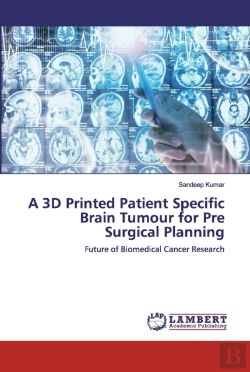 Bertrand.pt - A 3d Printed Patient Specific Brain Tumour For Pre Surgical Planning