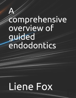Bertrand.pt - A Comprehensive Overview Of Guided Endodontics