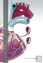 A Handbook Of Aortic Valve Disease