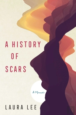 Bertrand.pt - A History Of Scars