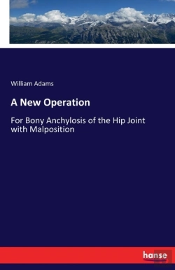 Bertrand.pt - A New Operation