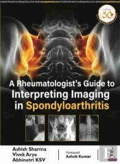 A Rheumatologist'S Guide To Interpreting Imaging In Spondyloarthritis