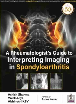 Bertrand.pt - A Rheumatologist'S Guide To Interpreting Imaging In Spondyloarthritis