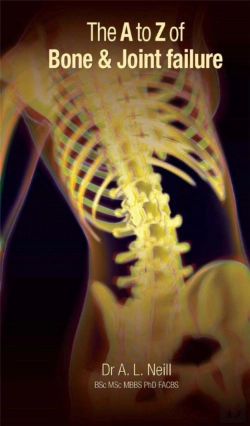 Bertrand.pt - A To Z Of Bone & Joint Failure