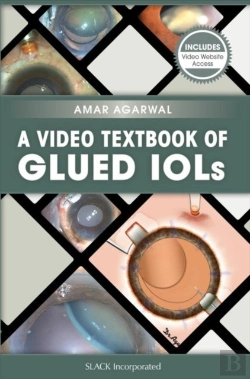 Bertrand.pt - A Video Textbook Of Glued Iols