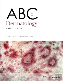 Bertrand.pt - Abc Of Dermatology
