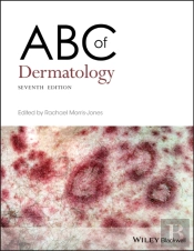 Abc Of Dermatology