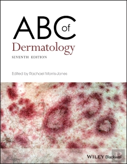 Bertrand.pt - Abc Of Dermatology