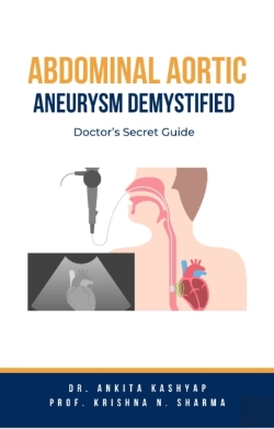 Bertrand.pt - Abdominal Aortic Aneurysm Demystified: Doctor'S Secret Guide