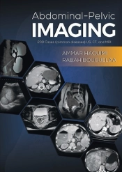Abdominal-Pelvic Imaging