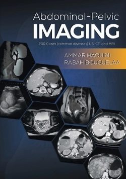 Bertrand.pt - Abdominal-Pelvic Imaging