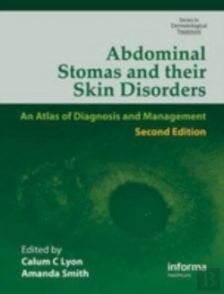 Bertrand.pt - Abdominal Stomas And Their Skin Disorders