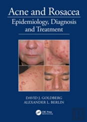 Acne And Rosacea