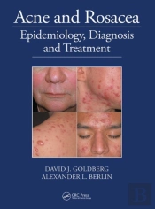 Acne And Rosacea