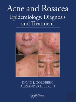 Bertrand.pt - Acne And Rosacea