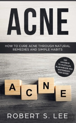 Bertrand.pt - Acne