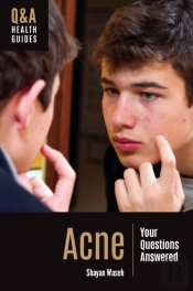 Acne