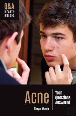 Bertrand.pt - Acne