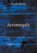 Acromegaly