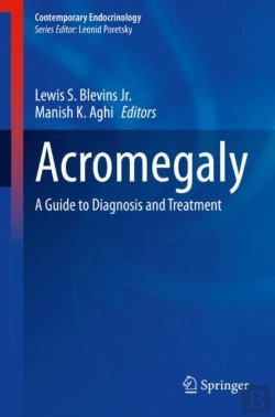 Bertrand.pt - Acromegaly