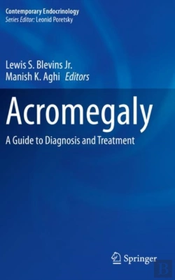Bertrand.pt - Acromegaly