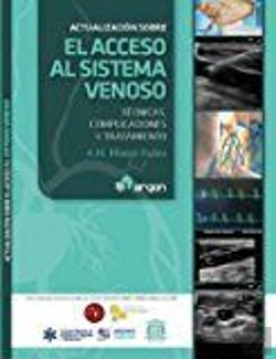 Bertrand.pt - Actualización Sobre El Acceso Al Sistema Venoso