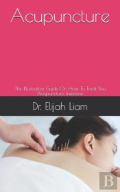 Acupuncture
