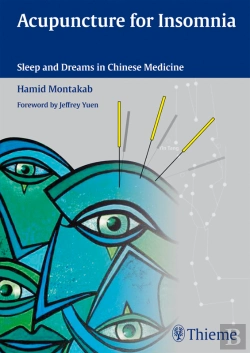 Bertrand.pt - Acupuncture For Insomnia