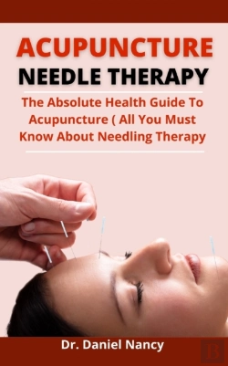 Bertrand.pt - Acupuncture Needle Therapy
