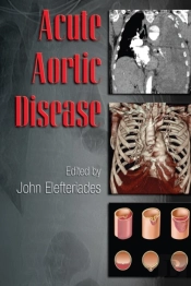 Acute Aortic Disease