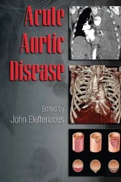 Bertrand.pt - Acute Aortic Disease