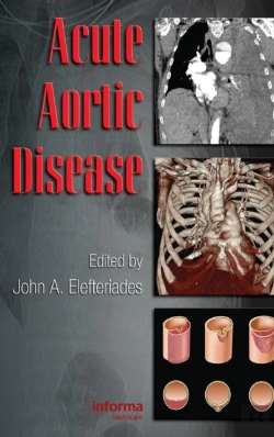 Bertrand.pt - Acute Aortic Disease